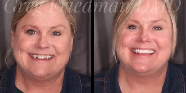 Find a good dentist in Coeur d'Alene